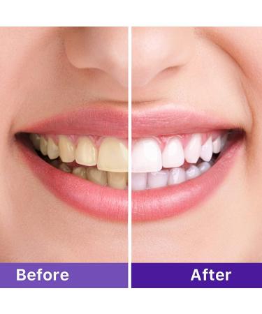 Nolipem Purple Toothpaste for Teeth Whitening | Effective Stain Removal & Teeth Brightening - Buy Online on GoSupps.com
