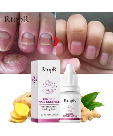 Nail Nail Toe 10ml Nail Drill for Gel Nails (multicolor One Size) 1 ml (Pack of 1) Multicolor - Buy Online on GoSupps.com