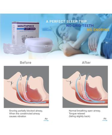 Dreamhero Mouth Guard - Dreamhero Mouth Guard Snoring Snoredestroy Mouth Guard Snoring Dreamhero Mouthguard Sleep Dreamhero Anti-Snoring Anti-Molar Silicone Braces Dental Tray 3pc - Buy Online on GoSupps.com