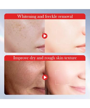 Lot de 2 cr mes claircissantes l'acide kojique pour le visage cr me hydratante et claircissante pour le visage anti-rides et raffermissante hydratante - Buy Online on GoSupps.com
