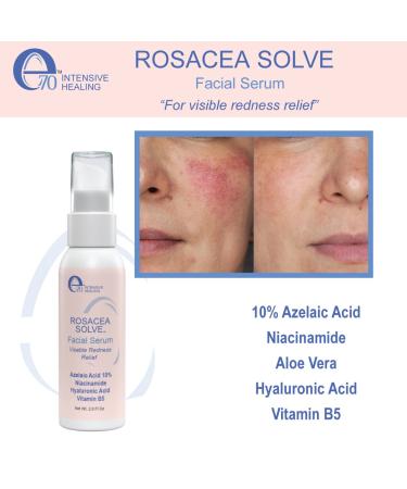 Rosacea Solve Set - Rosacea Cream, Serum, and Face Wash with Aloe Vera, Hyaluronic Acid, Niacinamide & More - Buy Online on GoSupps.com