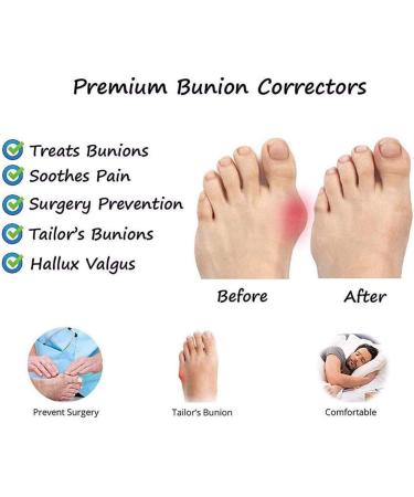 Shop Women s Bunion Sandals - PU Leather Big Toe Correction Casual Slide Shoes for Summer Hiking & Beach - Adjustable Black - Buy Online on GoSupps.com