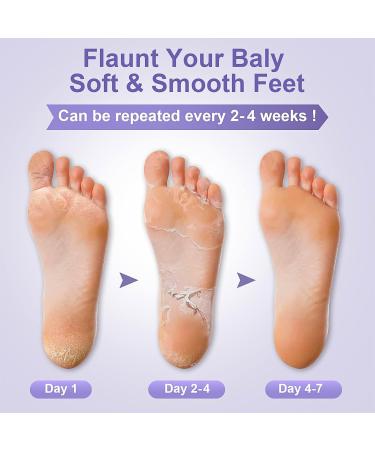 3 Pairs Foot Peel Mask for Hard Skin Exfoliating Foot Peel Mask Callus Remover for Feet Foot Moisturiser Socks for Foot Care Cracked Heel Dead & Dry Skin Foot Mask for Women & Men - Lavender - Buy Online on GoSupps.com