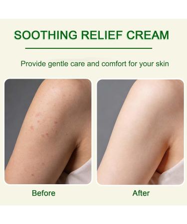 MAYLOR Soothing Moisture Cream for Sensitive & Dry Skin Fragrance-Free Daily Hydrating Lotion Non-Greasy Formula 1.06 oz (01) - Buy Online on GoSupps.com