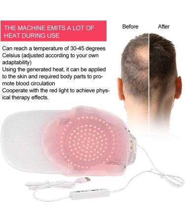 Laser Cap for Hair Regrowth - 108 Lamp Beads Hair Growth Hat for Men and Women - Oil Control Hair Loss Care Instrument - White Hat - Buy Online on GoSupps.com