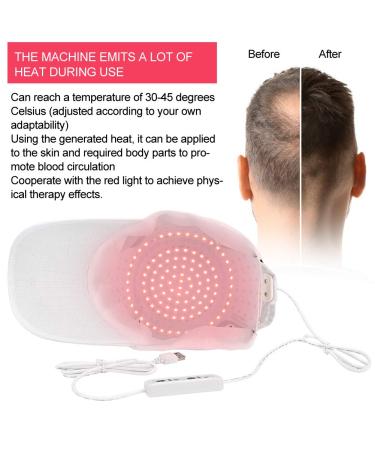 Therapy Alopecia Helmet for Hair Growth | 108 Lamp Beads | Anti-Hair Loss Treatment - International Shipping Available - Buy Online on GoSupps.com