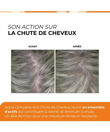 Cuure Anti-Hair Loss Complex for Men - 9 Active Ingredients - Biotin Zinc Saw Palmetto Vitamin B6 & B8 - Dense and Resistant Hair Growth - 30 Days - Made in France - Buy Online on GoSupps.com