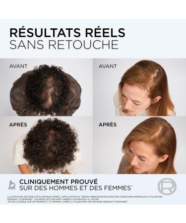 L'Or al Paris Elseve Fiber Booster Anti-Hair Loss Serum 102ml - Buy Online on GoSupps.com