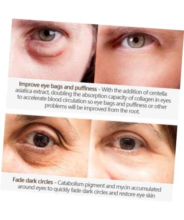 Mikinona Essence Eye Cream Eye Creams Cream for Eye Makeup Accessories Eye Crean Dark Circle Eyes White Anti Wrinkle Cream - Buy Online on GoSupps.com