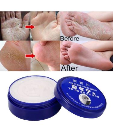 Lintat Hand & Foot Crack Cream | Natural Moisturizer for Dry Skin Heels & Chapped Skin | Anti-Dry Ointment for Int'l Shipping - Buy Online on GoSupps.com