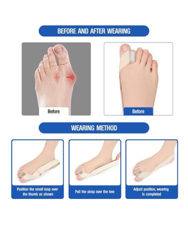 Bunion Corrector & Big Toe Separators for Pain Relief | Hallux Valgus & Overlapping Toe Treatment - 2 Pairs for Men & Women - Buy Online on GoSupps.com