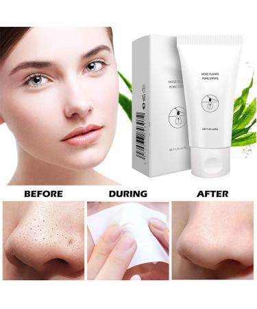 Nose Pore Strips Black Head Remover For Nose Blackhead Mask Blackhead Nasal Membranes Nose Strips Pore Strips for Blackheads Blackhead Strips Blackhead Remover for All Skin Types 30g 30 ml (Pack of 1) - Buy Online on GoSupps.com