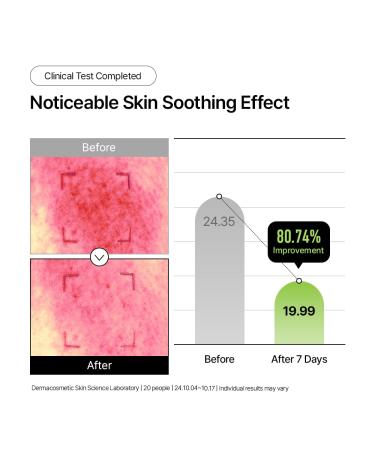 Parnell Panthenol Calming Duo | Serum 5.78% & Cream 3.89% Set | Heartleaf Provitamin B5 Soothing Moisturizer for Sensitive Skin K-Beauty - Buy Online on GoSupps.com