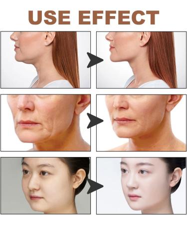 V-Shaped Lifting Mask & Instant Face Lifting Tape | Anti-Wrinkle Plasters for Sagging Skin | 2.5cm x 500cm - Buy Online on GoSupps.com