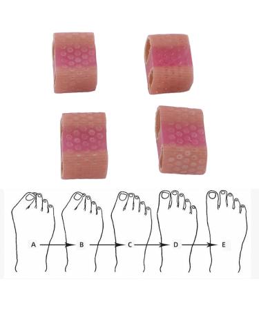 Bunion Toe Separator Corrector | 4pcs Hammer Toe Relief & Ingrown Toenail Treatment | Reduce Friction & Discomfort - Buy Online on GoSupps.com