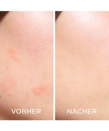 ARTDECO Perfect Teint Corrector - Correction Cream Stick 1.8ml | Flawless Coverage for All Skin Types | International Shipping - Buy Online on GoSupps.com