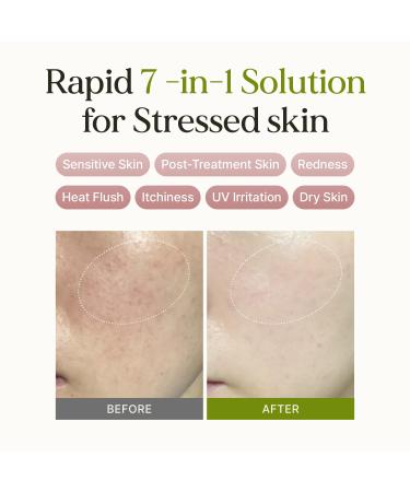 Rbfy. 7 Relief Ampoule Pad (100 pads) Quick Calming & Soothing Serum-Infused Toner Pads with 7 Herbal Blend Moisturizing Comfort for Stressed and Sensitive Skin | Family-Friendly Korean Skincare - Buy Online on GoSupps.com
