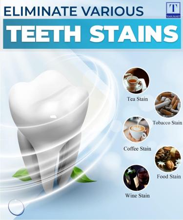Advanced 5D Teeth Whitening Strips - Gentle on Sensitive Teeth - 14 Sessions for a Brighter, Whiter Smile - Buy Online on GoSupps.com