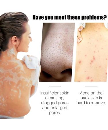  HADAVAKA Turmeric Soap For Skin Lightening Smooth And Gentle Turmeric Bath Soap For Men And Women 100g Ginger Soap Moisturizing And Deep Cleansing (2PCS) - Buy Online on GoSupps.com