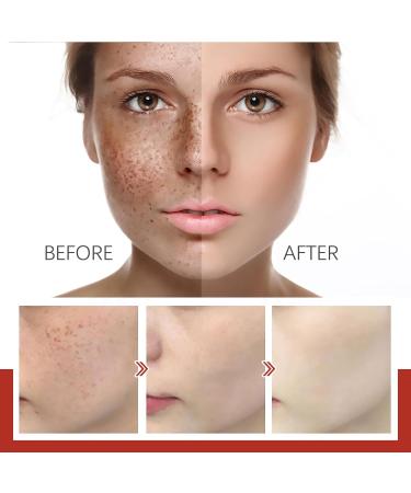 Pigment Correcting Cream Pigment Correcting Brightening Cream Anti-Pigment Pigment Correcting Cream Dark Spot Corrector Daily Face Serum Brightening Face Moisturizer For Melasma Spot - Buy Online on GoSupps.com