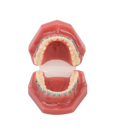 Orthodontic model orthodontic demonstration model orthodontic bracket model 28 partial dental resin model