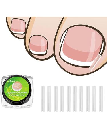 BEALIFE Curved Toenail Corrector Strips for Ingrown Toenails Effective Foot Care Solution - Buy Online on GoSupps.com