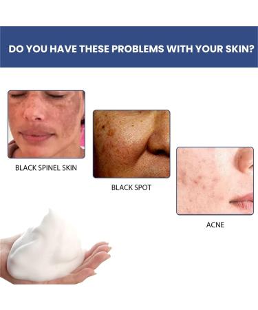 Cleansing Lotion for Acne & Spots | Acanthosis Nigricans Treatment Set - Salyzap Body Wash, Nigrifree Cream, Therapy Oil | 50ml - 1 Count (Pack of 2) - Buy Online on GoSupps.com