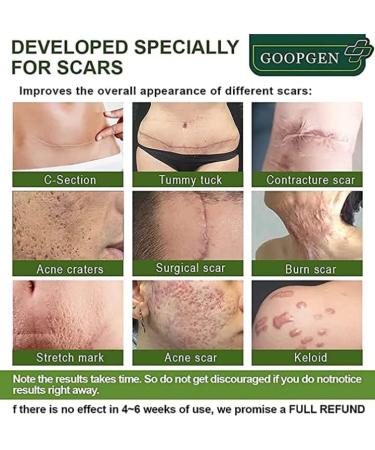 30ml Goopgen Medical Grade Scar Repair Serum - Nature Scar Treatment for All Types of Scars (1pcs) - Buy Online on GoSupps.com