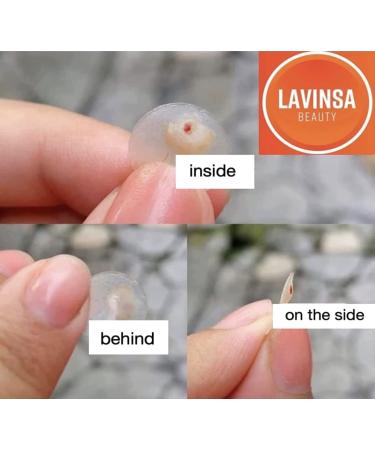 Pimple Patches 180 Count with Tweezers - Hydrocolloid Acne Cover Patch for Quick Healing - Spot Stickers for Face and Skin - Buy Online on GoSupps.com