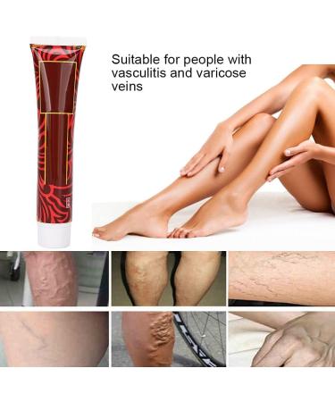 Varicose Vein Treatment Cream for Phlebitis & Angiitis | Blood Vessel Health Care - Buy Online on GoSupps.com