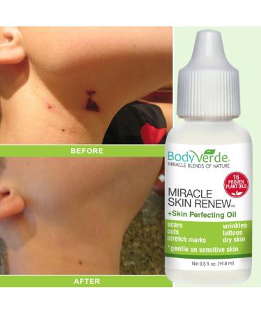 BodyVerde 100% Natural Miracle Skin Renew (Incredible multipurpose serum to support rapid skin healing in children and adults) - Buy Online on GoSupps.com