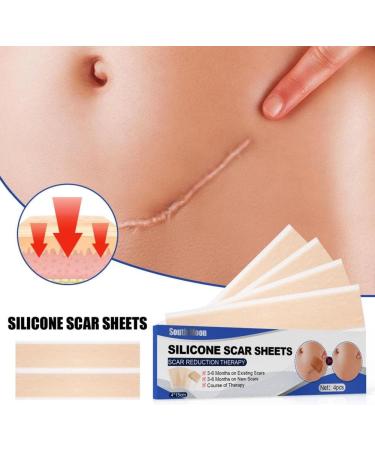 Universal Scar Repair Sticker | Soft Skin Patch | Lighten Pigmentation | Surgical Scar Repair | 4Pcs (Style A/S) - Buy Online on GoSupps.com