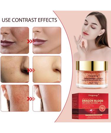 Fengyang Dragon Blood Cream Firming Face Cream Retinol Placenta Dragon Cream Anti-wrinkle Cream for Women Moisturizes and Brightens Complexion (S 50g) - Buy Online on GoSupps.com