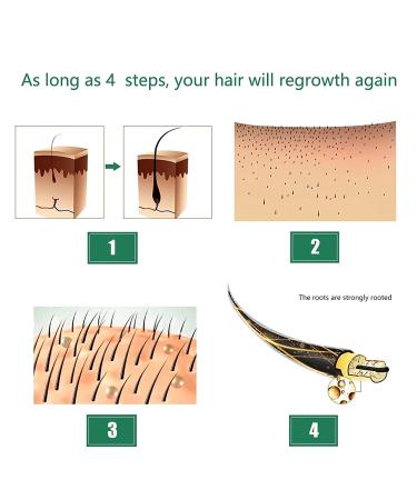 Ginger Oil 5-Pack for Hair Growth - Biotin Serum for Men & Women - Promotes Thicker & Healthier Hair - Hair Loss Treatment Included - Buy Online on GoSupps.com