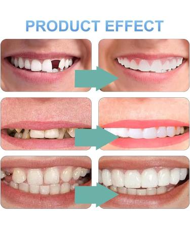 IKSVMSI False Teeth for Plug-In | 2 Pairs Cosmetic Veneers - Top & Bottom - Carnival Prostheses for Men & Women - Buy Online on GoSupps.com