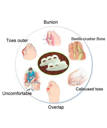 Pedimend Gel Hammer Toe Splint Cushion | Toe Separators & Spacers for Hammertoes | Foot Care for Men and Women (White) - Buy Online on GoSupps.com