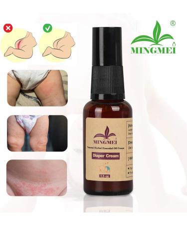 Natural Eczema & Urticaria Treatment Diaper Rash Cream for Babies - Mingmei Herbal Formula 1.5oz - Buy Online on GoSupps.com