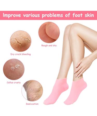 LINXINS Silicone Socks for Cracked Feet 2 Pairs Silicone Socks for Women Silicone Moisturising Socks Women Foot SPA Pedicure Silicone Socks Softening Dry Cracked Feet Rough Skins Pink & White - Buy Online on GoSupps.com