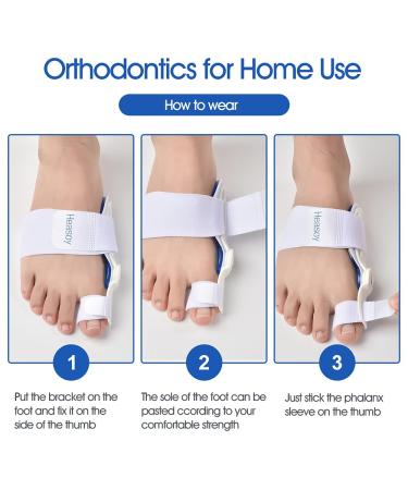 Heasoy Bunion Corrector - Gel Cushion Pads for Hallux Valgus Relief - Toe Straightener for Men & Women (2 Pairs) - Buy Online on GoSupps.com