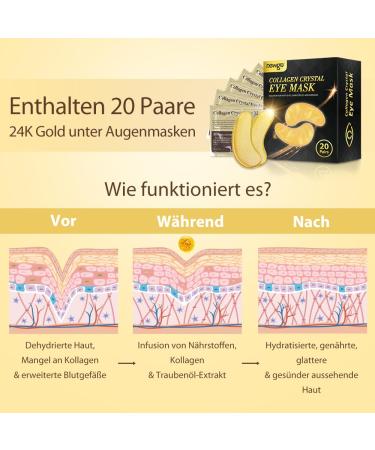 Newgo Eye Pads - 20 Pairs of Hyaluronic Acid Collagen Gel Pads for Dark Circles Puffiness & Anti-Fold Care - Buy Online on GoSupps.com