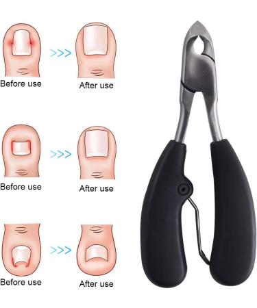 NACTECH Toenail Clippers Precision Heavy Duty Toe Nail Nippers Thick or Ingrown Nail Clippers Scissors Set with a Nail Lifter Gift Set Medical Grade Stainless Manicure Grooming Tool for Men Women - Buy Online on GoSupps.com