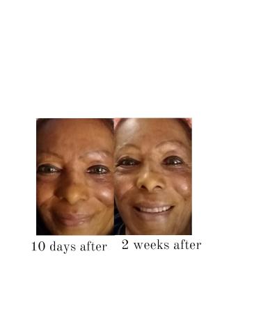 Best Advanced Anti-aging Face Brightener Organic Antiwinkles Acetyl-Glucosamine Serum + vitamin B3 (Niacinamide) Efficient Anti-aging Face Faster Wrinkle reduction Re-activate skin Youth (30 ml) - Buy Online on GoSupps.com
