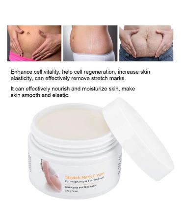 Stretch Stripes Cream 120g | Remove Stretch Marks Pregnancy Scars & Acne | Maternity Repair Treatment - Buy Online on GoSupps.com