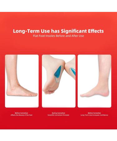 Arch Support Insoles for Flat Feet & Plantar Fasciitis | HZMEMNUN Comfort Insoles for Men & Women - 2 Pairs - Buy Online on GoSupps.com