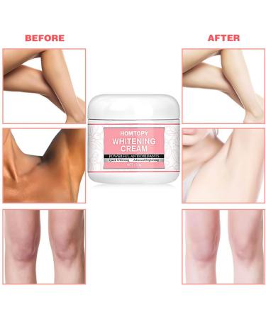  MagiSel Underarm Whitening Cream lightening cream whitening cream effective for underarms knees elbows sensitive and intimate areas whitens nourishes repairs and restructures the - Buy Online on GoSupps.com