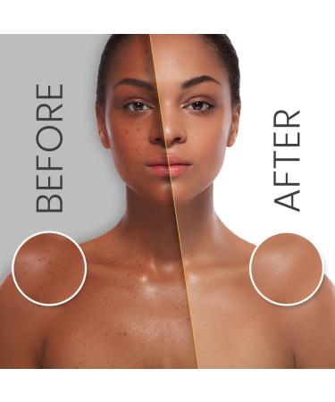 Buy Makari Naturalle Multi-Action Extreme Body Lotion 17.6oz - Whitening Moisture & SPF 15 - Toning & Brightening Treatment for Dry Skin & Age Spots - Argan Oil Formula - Buy Online on GoSupps.com