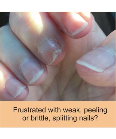 Penetrating Fingernail Conditioner & Strengthener | Repair Weak Peeling & Brittle Nails - 1 Bottle - International Shipping - Buy Online on GoSupps.com