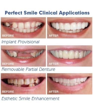 Zmoope Instant Veneers - 10 Pair Temporary Smile Cosmetics | Comfort Fit Dentures & Teeth Stickers for Perfect Smile - Buy Online on GoSupps.com