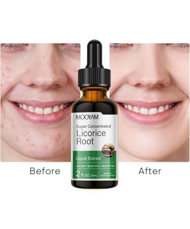 Licorice Root Facial Serum Moisturizing and Even Skin Tone Anti-Wrinkle Minimize Fine Lines Remove Acne Firming and Strengthening Skin Care Concealer - Buy Online on GoSupps.com