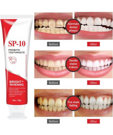 VYIBPDY SP10 toothpaste 120 g probiotic toothpaste provides effective teeth whitening and protection of the gums fights plaque and ensures longlasting fresh breath - Buy Online on GoSupps.com